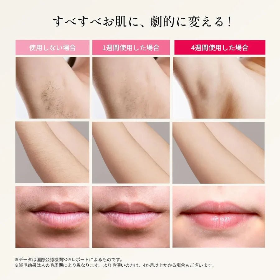 【高度な冷却技術】光美容器 脱毛器 強力パルス光 メンズ・レディース対応 全身脱毛（髭/脇/VIO/脚/腕）家庭用 無痛設計 高効率・高耐久 エステサロン級の効果 自宅で簡単に使用可能 - 光点 - 光点